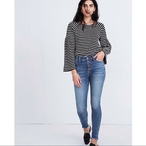 Madewell 10” High Rise Button Front Skinny Jean